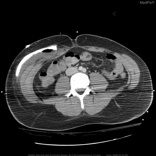 Surgical storage of craniotomy fragment pending definitive management