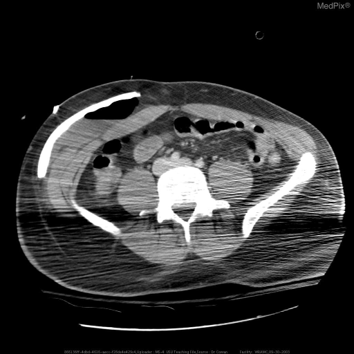 Surgical storage of craniotomy fragment pending definitive management