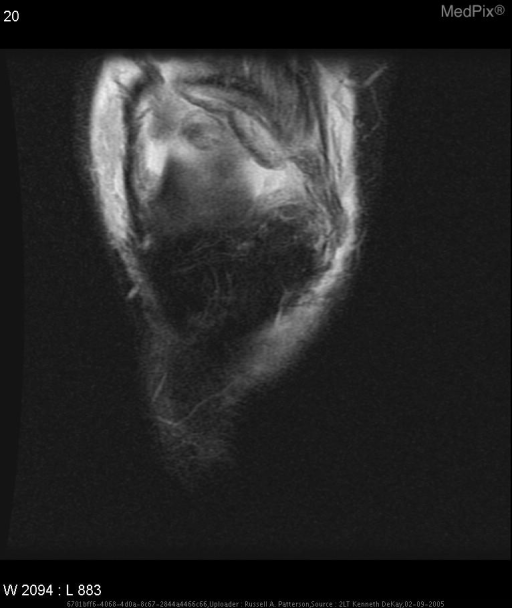 MPX2204_synpic23801
