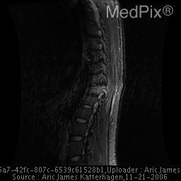 MPX2376_synpic33071